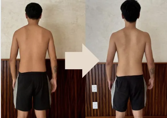 Member posture change, back view before and after